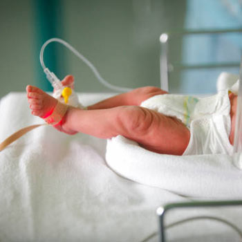 NICU (Neonatal Intensive Care Unit)