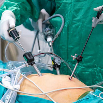 General & laparoscopic surgery in Vijayawada