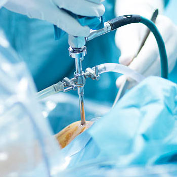 arthroscopy hospital in vijaywada