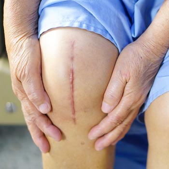 joint replacement hospital in Vijayawada